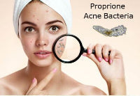 Acne Control, Treat & Prevention
